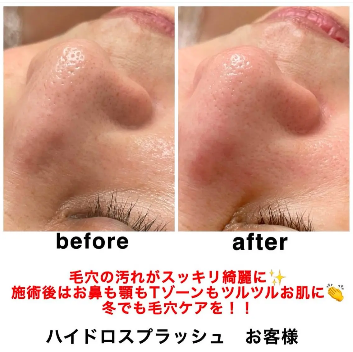 エステ リラク ネイル・エステサロン UILANIのエステ・リラクイメージ
