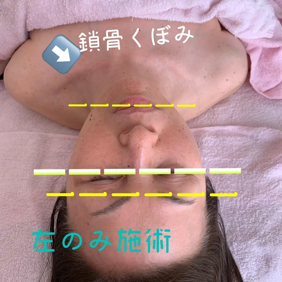 美容整体発😉頭部整顔セラピー💆♀️⭐️16,500円→8,800円の写真