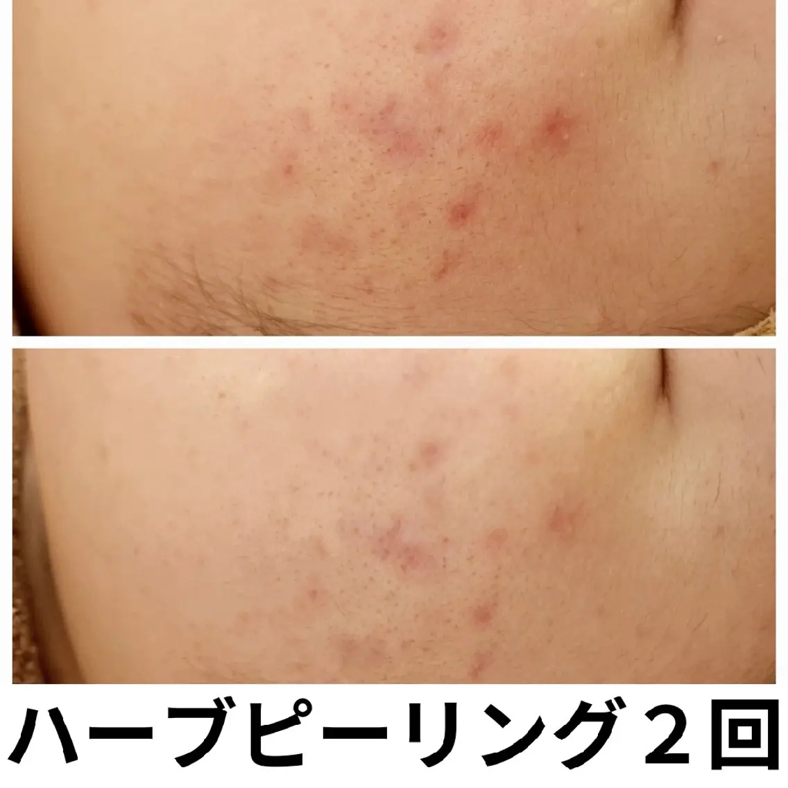 フェイシャル専門サロ ン ERINのエステ・リラクイメージ