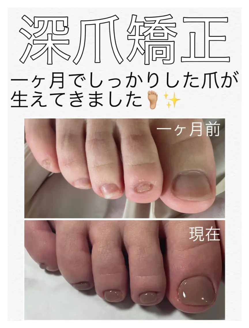 ネイル 長さ出し フットネイル nail salon petillantのネイルデザイン