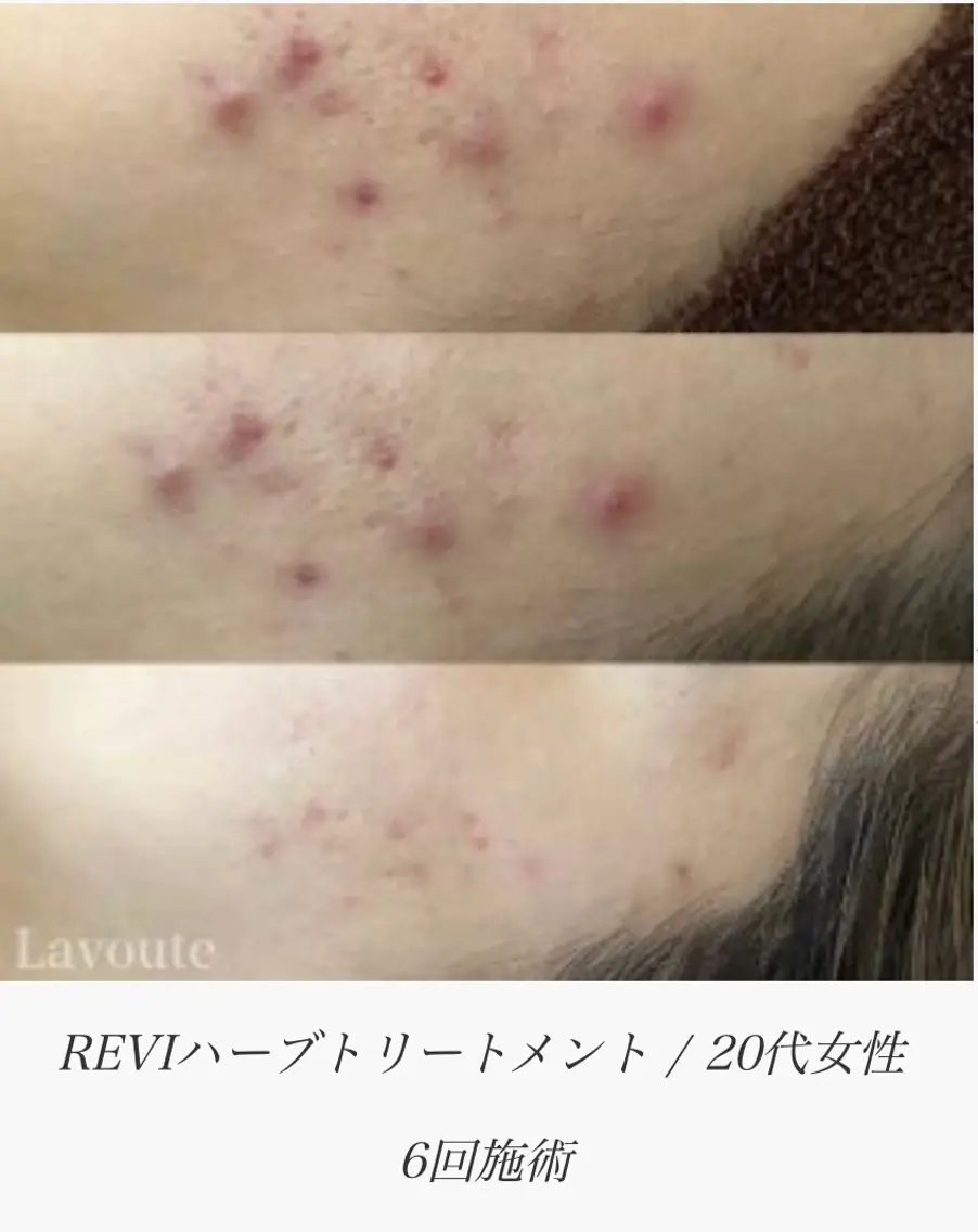 ネイル&エステ phuan(プアン)のネイルデザイン