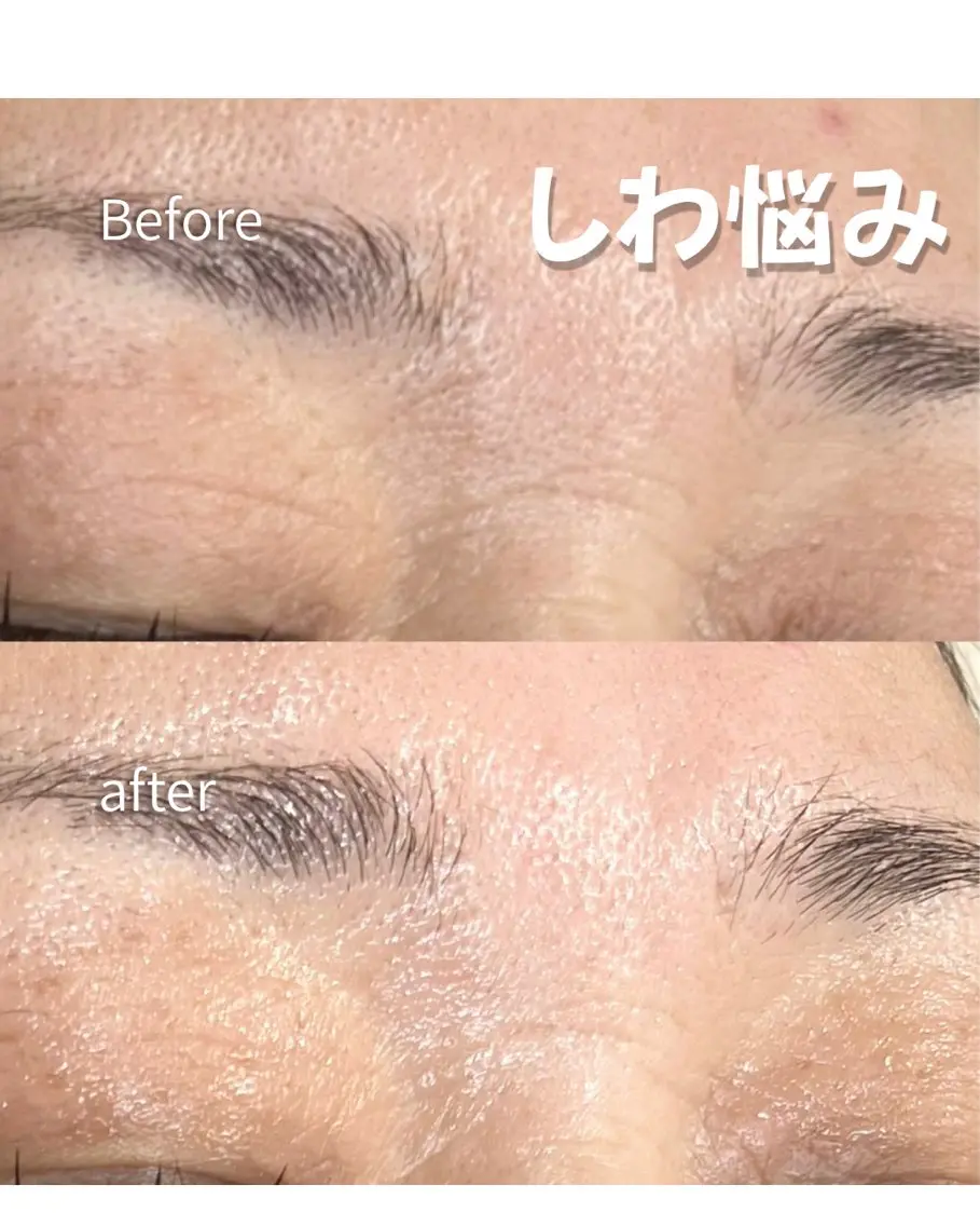 エステ Balance facialのその他イメージ