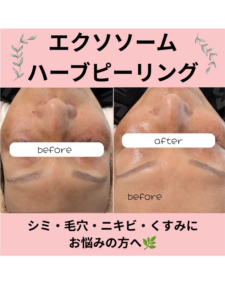 エステ SOLEILnail &beautyのエステ・リラクイメージ