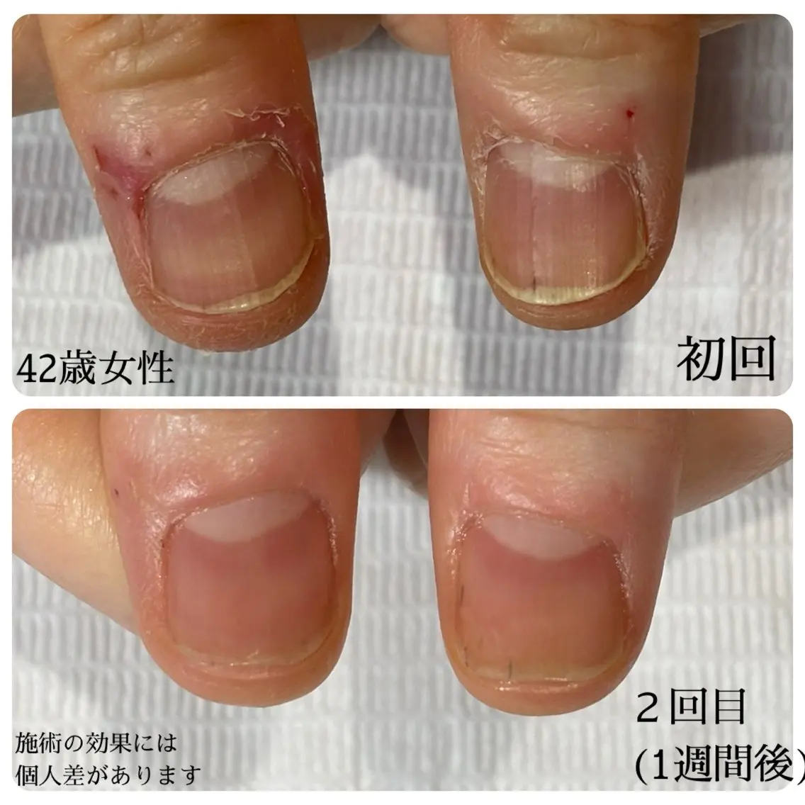 ネイル 自爪育成専門サロン エムロードゥ池下のネイルデザイン