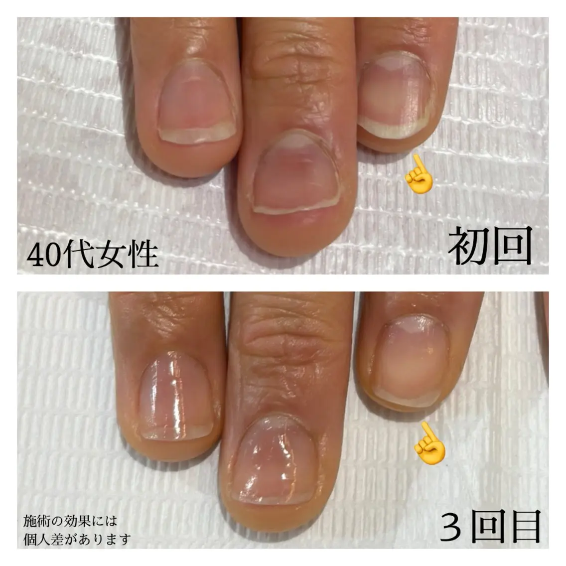 ネイル ピンク 自爪育成専門サロン エムロードゥ池下のネイルデザイン