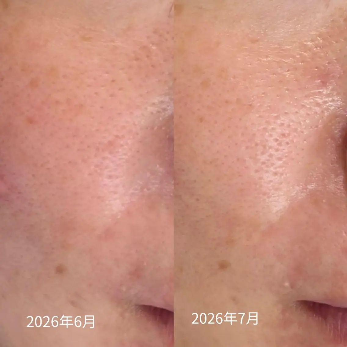 エステ Balance facialのエステ・リラクイメージ