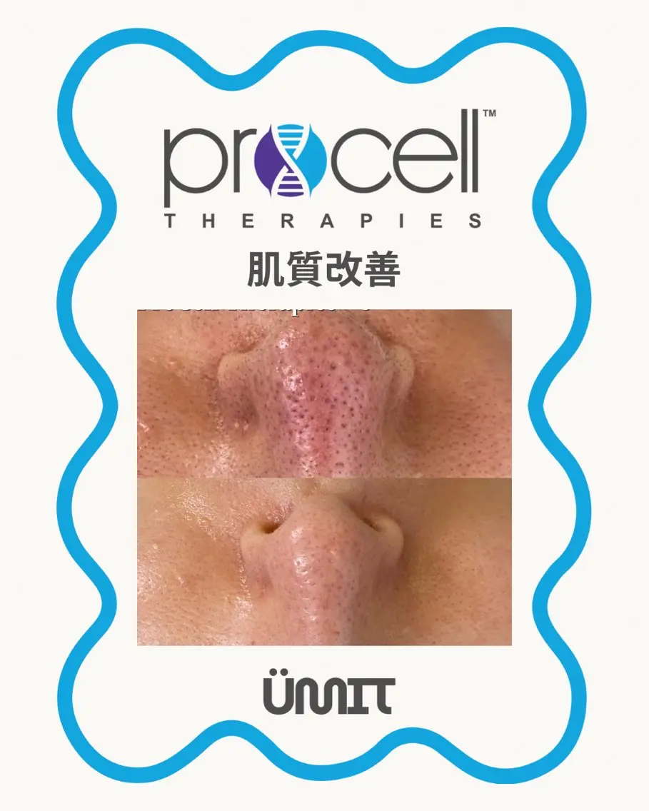 エステ Ümit（ユミト） プロセルセラピーズのヘアスタイル