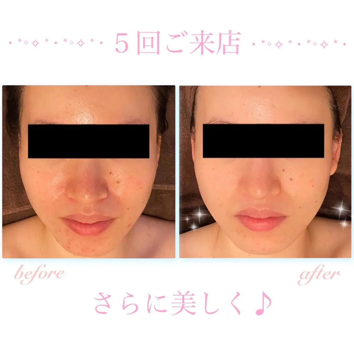 エステ リラク ダイエット・美肌ケア fleurのエステ・リラクイメージ