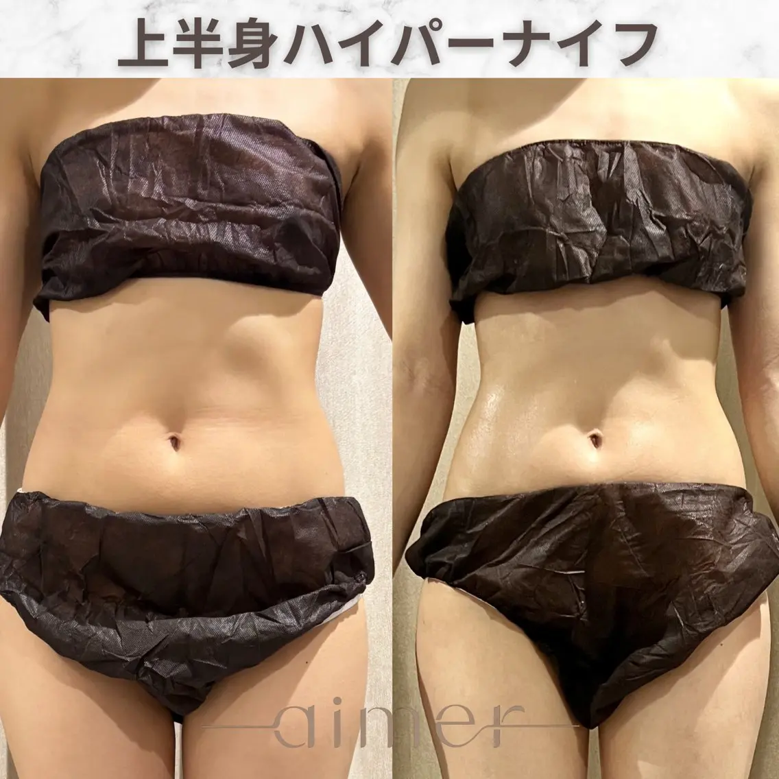aimer服部 /  小顔 ・ 痩身のその他イメージ