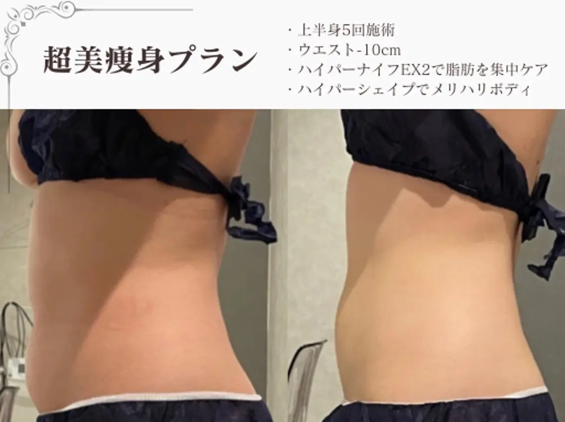 エステ リラク 総合美容サロン LOVEME渋谷本店のエステ・リラクイメージ