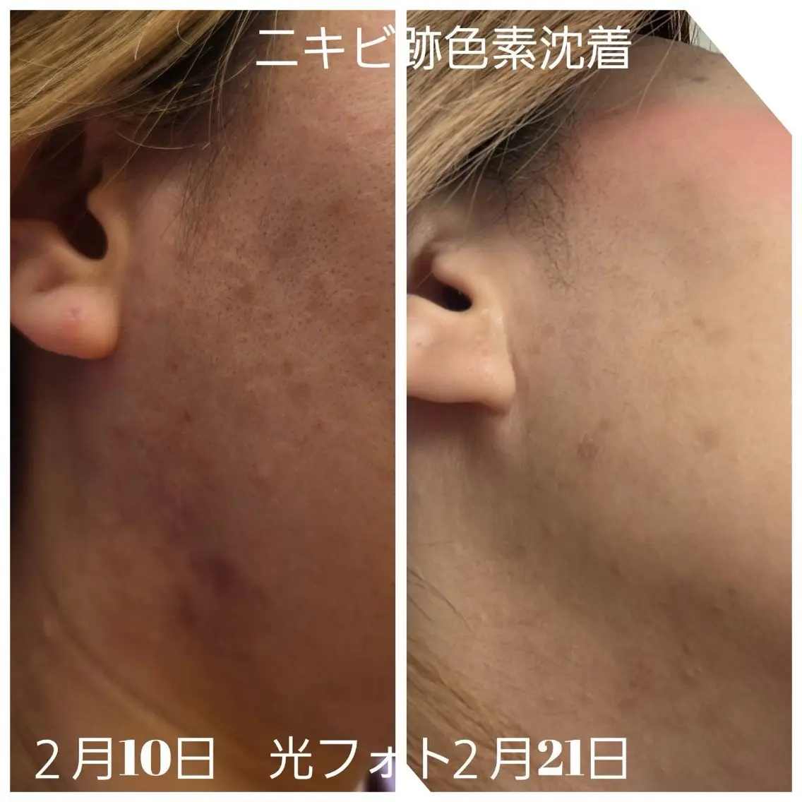 ilima NARUMIのエステ・リラクイメージ