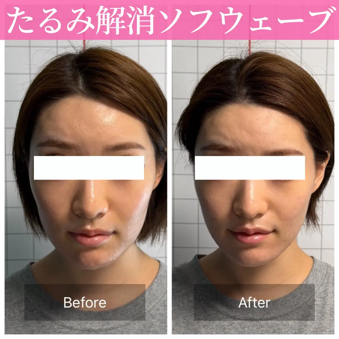 エステ リラク 小顔矯正・美肌ケア 池田 桃花のエステ・リラクイメージ
