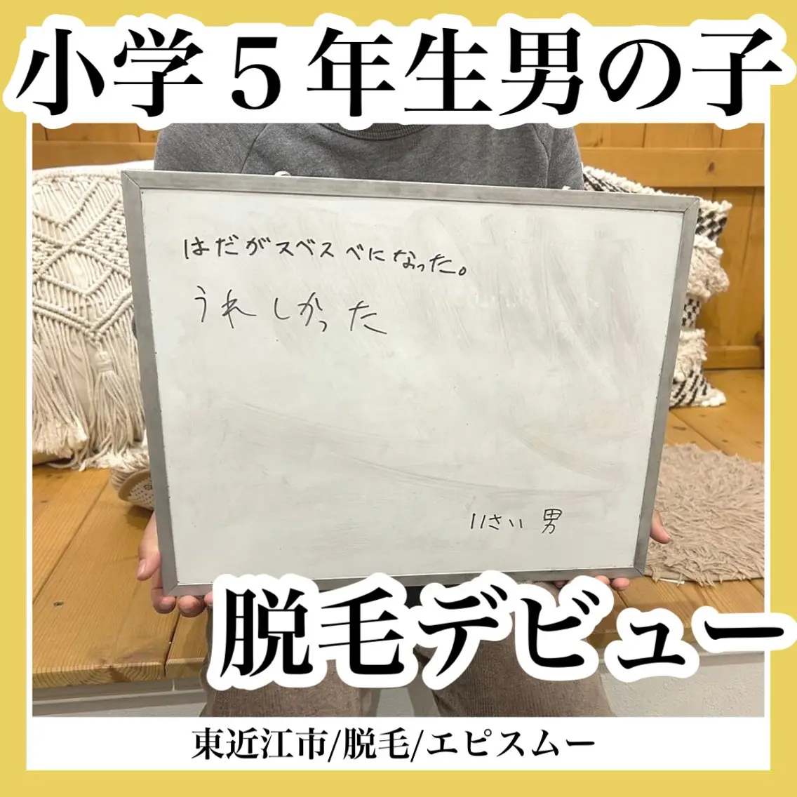 メンズ キッズ 学生(メンズ向け) epismoo 脱毛/HBL/毛穴の眉毛・アイブロウイメージ
