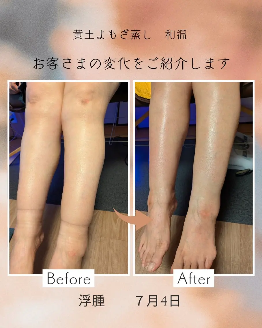 黄土よもぎ蒸し 和温のエステ・リラクイメージ