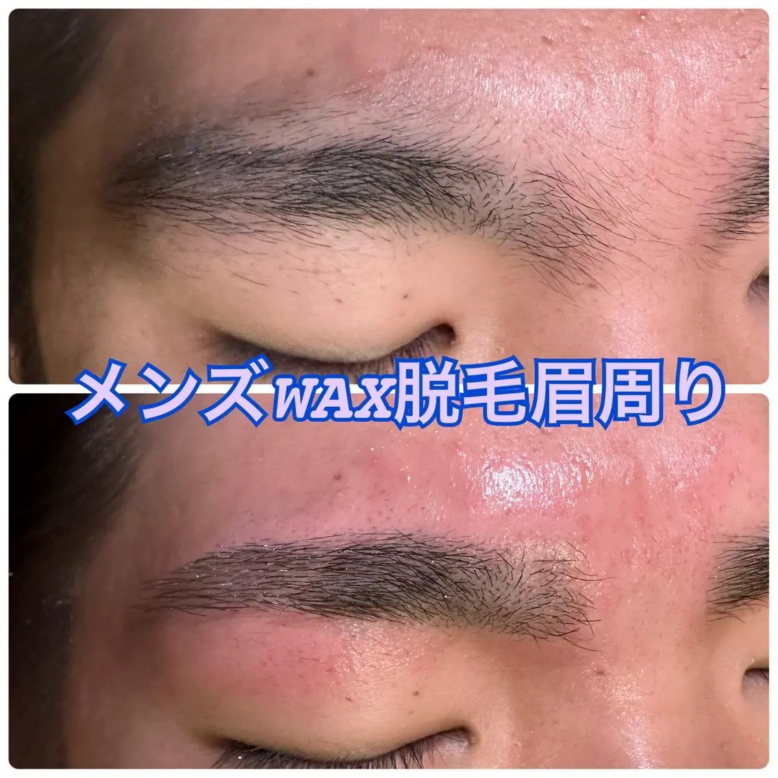 メンズ アイブロウ メンズアイブロウ 眉毛ワックス脱毛 ワックス脱毛 その他(アイブロウ) みかん整骨院 アイブロウ七彩の眉毛・アイブロウイメージ