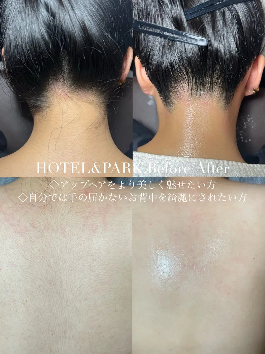 HOTEL&PARK Mikuワックス脱毛のエステ・リラクイメージ