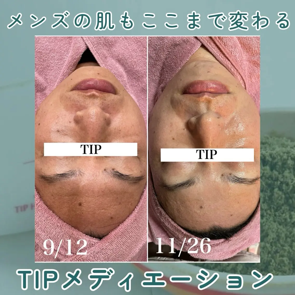 メンズ エステ skin salon enのエステ・リラクイメージ