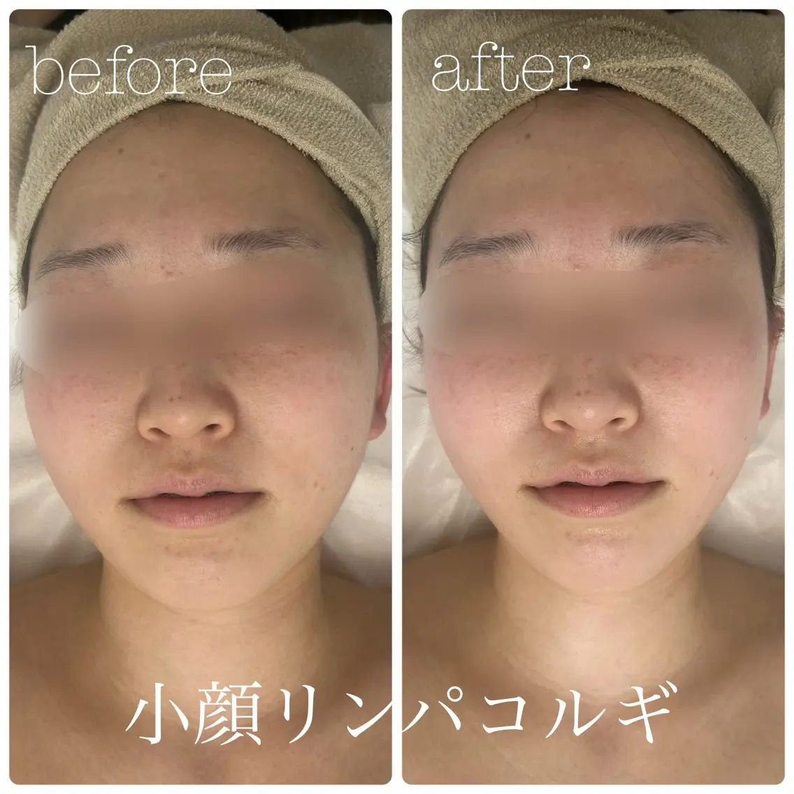 フェイシャルサロン CHIARA 荒田のエステ・リラクイメージ