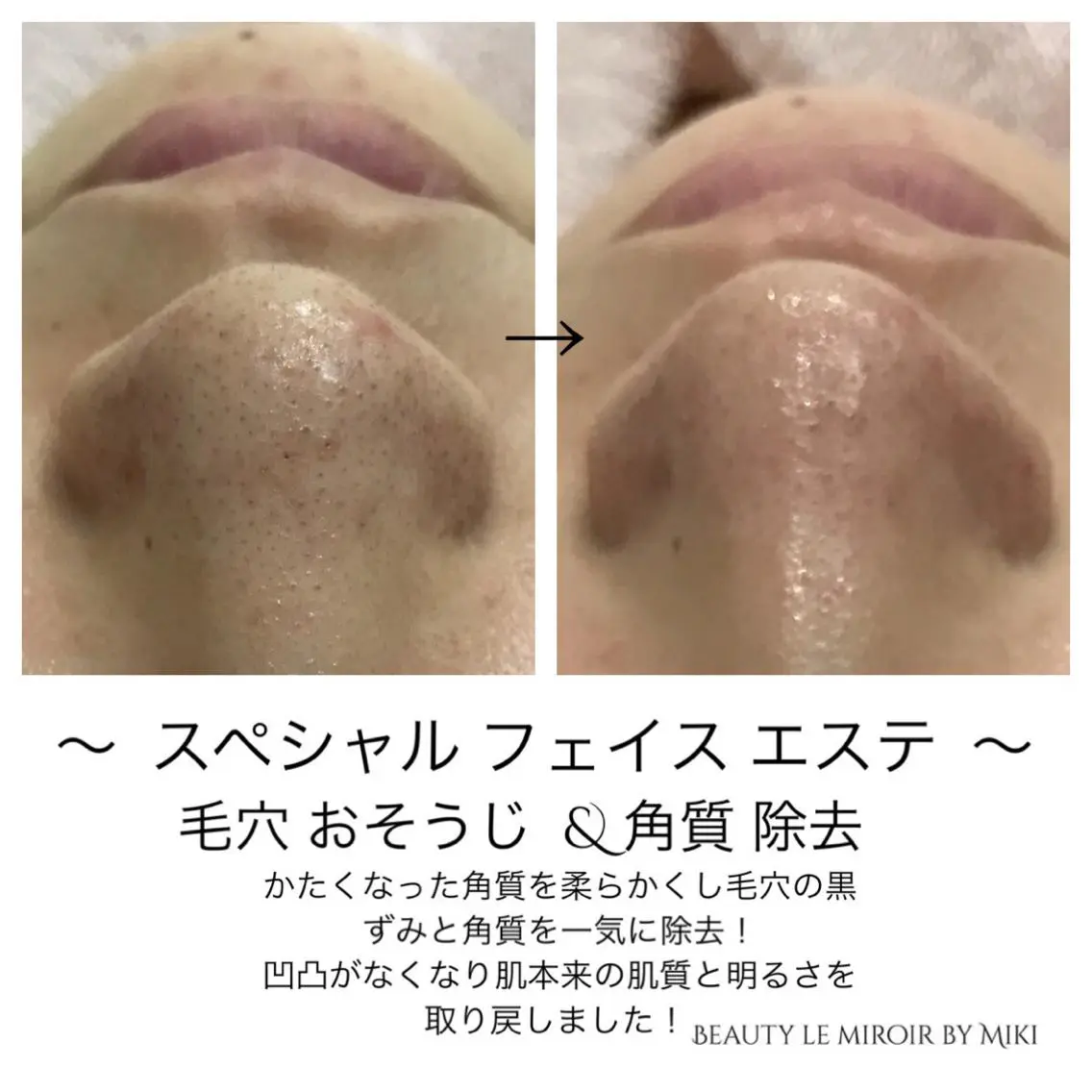 ビューティー ミロワールのエステ・リラクイメージ