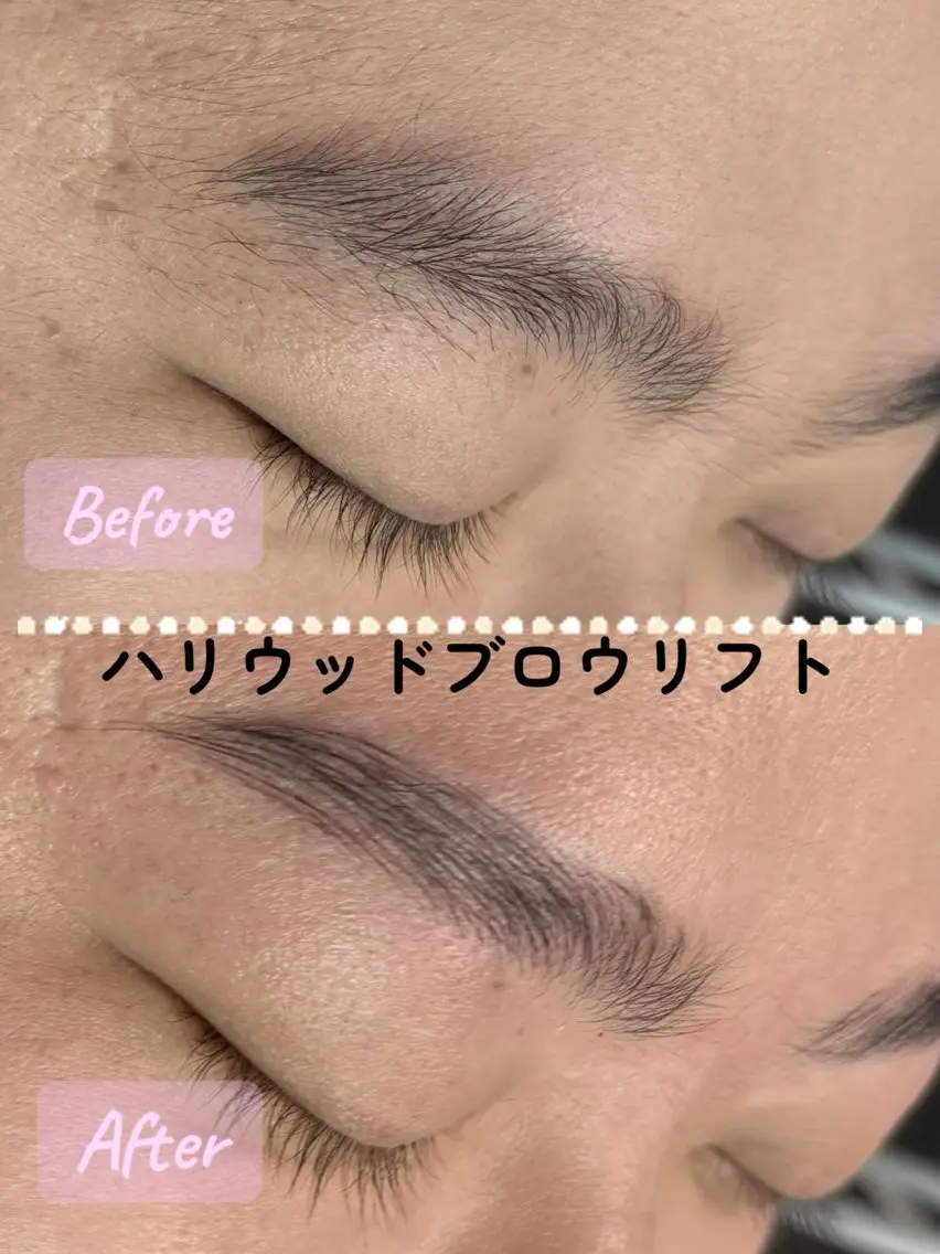 【メンズ👱‍♂️ハリウッドブロウリフト×ワックス脱毛🌿】六本木/銀座/毛流れをつけ清潔感のあるかっこいい眉毛に🌟の写真