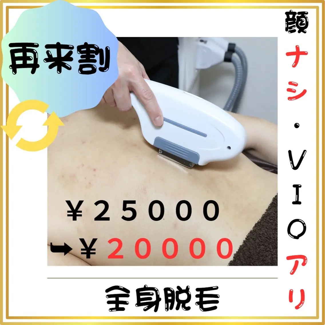 🔄再来割🔄【全身脱毛（顔無・VIO有）】 (#メンズ脱毛 　#第一印象UP  #都度払い)の写真