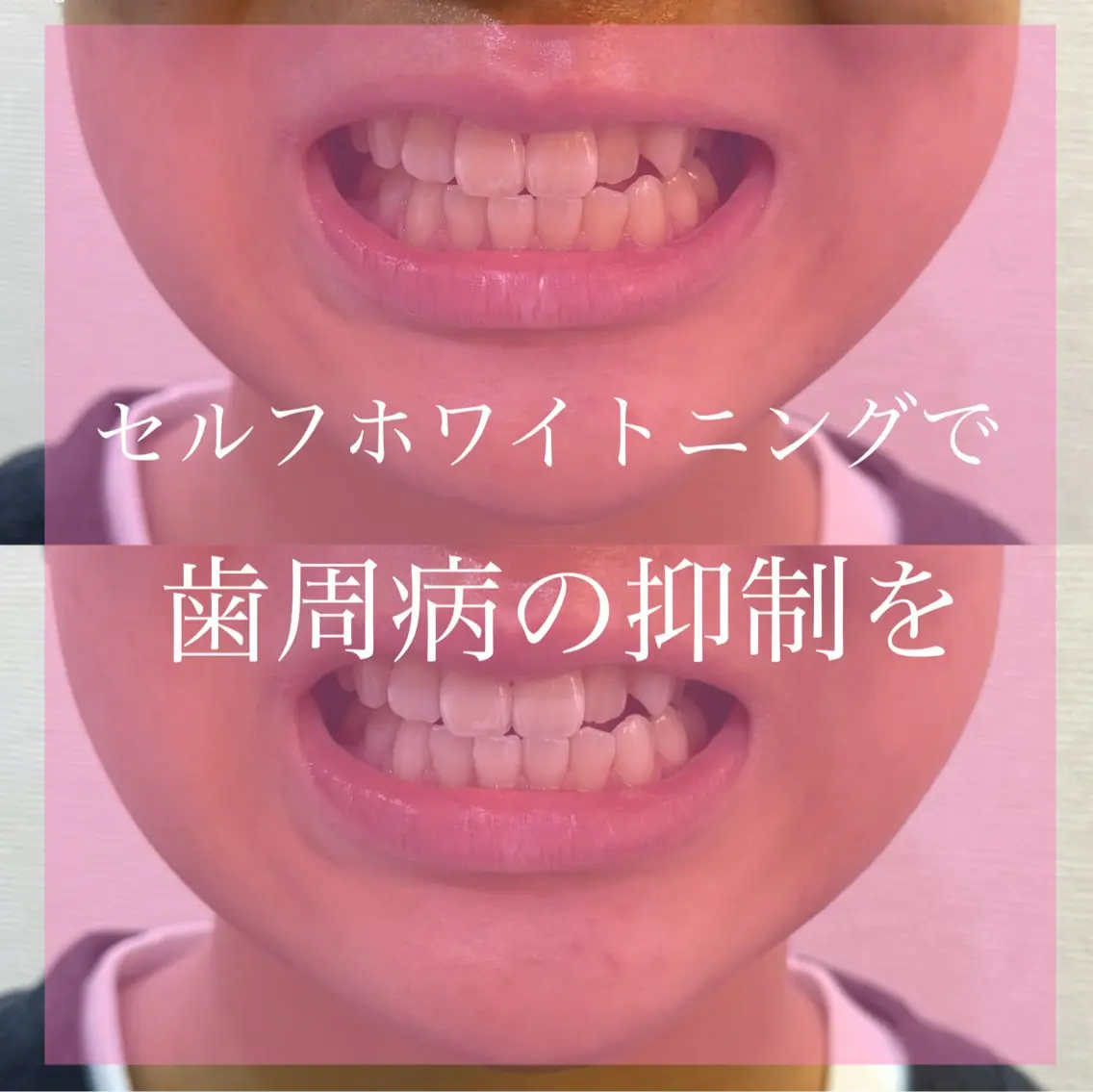 Livicate 💗🧁🎀🦋のマツエク・マツパデザイン