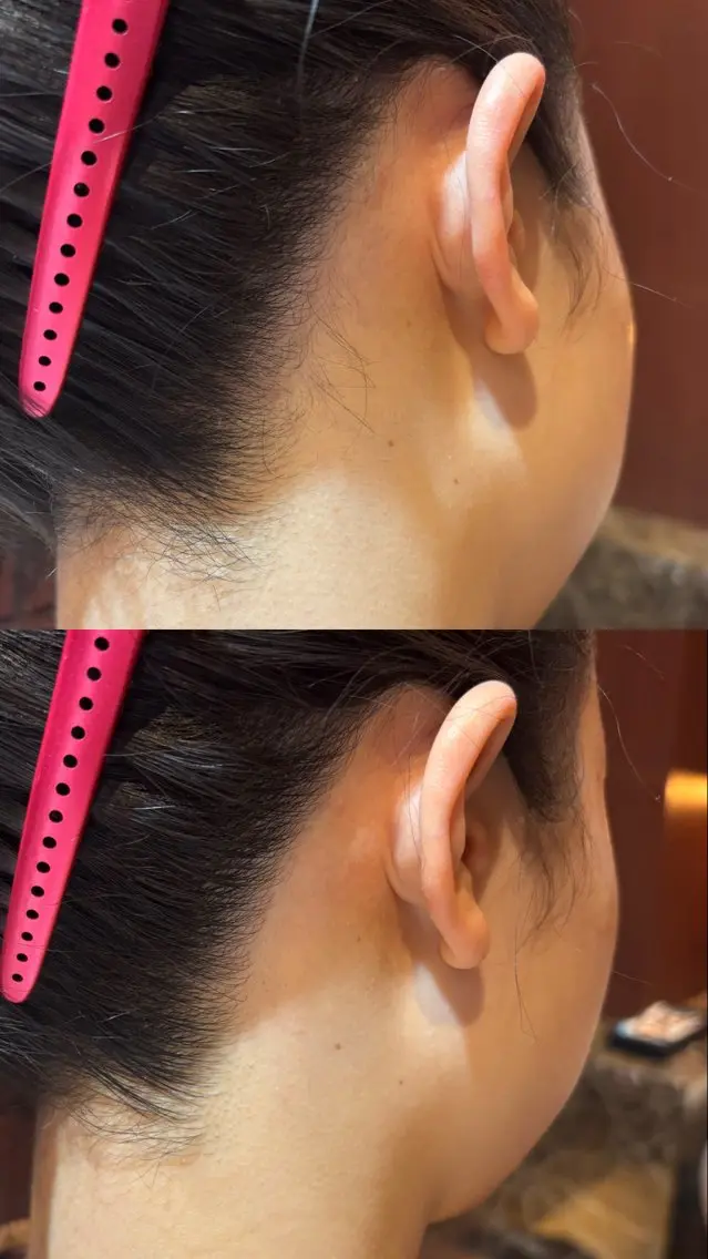 顔・うなじの写真