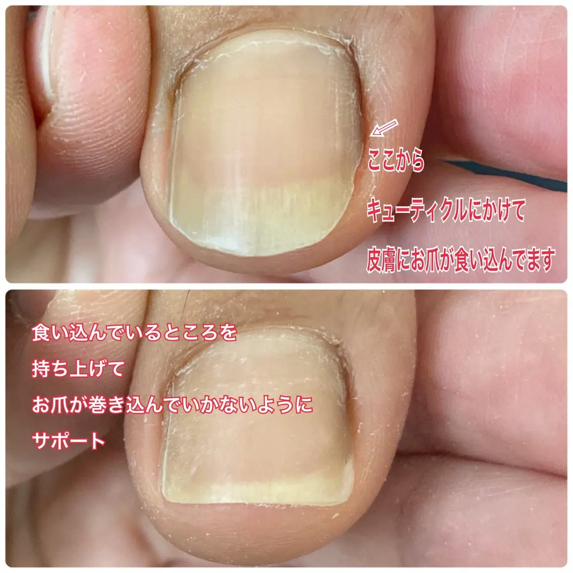 ネイル フットネイル ジェルネイル Lotus Nailのネイルデザイン