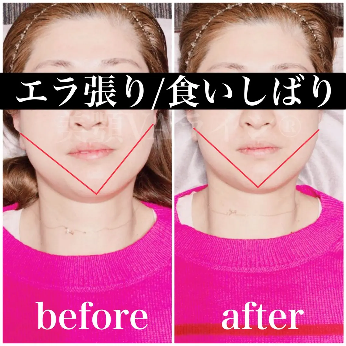 🌈歪み専門🌈 バリンタイ すぎうらのエステ・リラクイメージ
