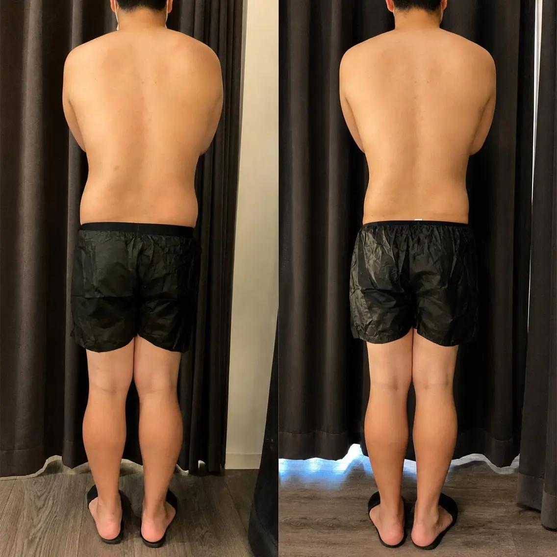 【人気No1🔥】冷却痩身❄️痩せたい部位の脂肪を集中アプローチ！2部位（4カップ）【筋膜リリース、引き締め美容液付き】の写真