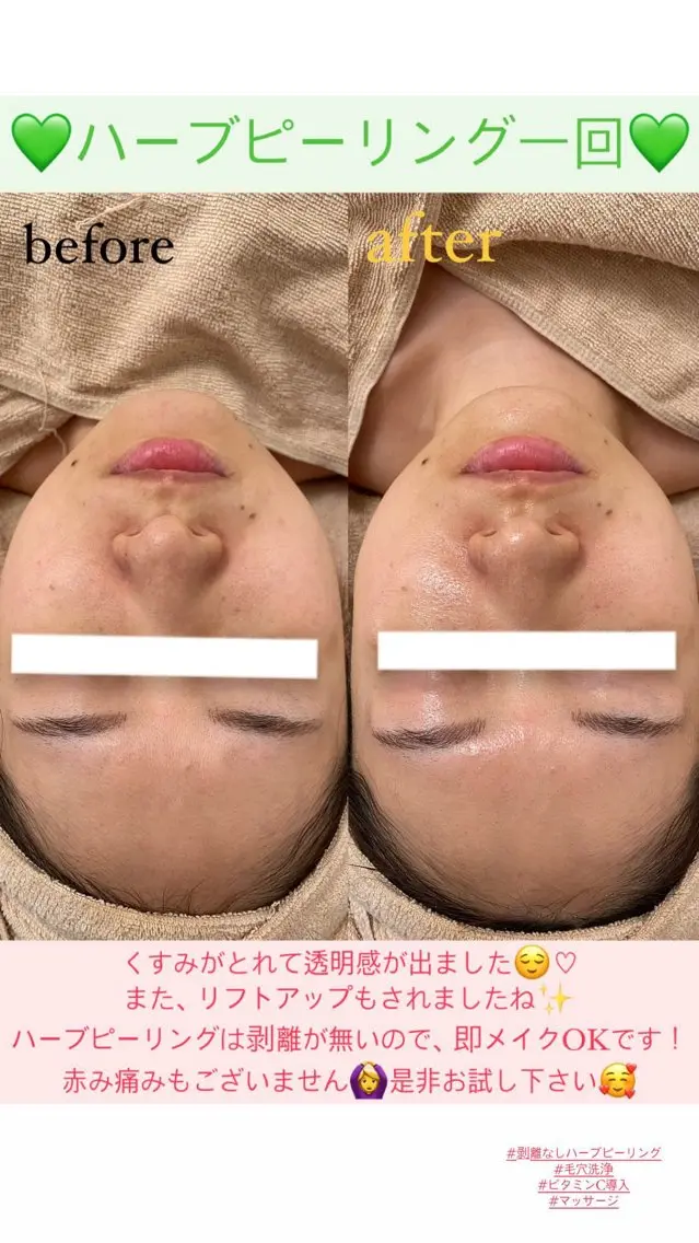 メンズ エステ Salon de Lino 御器所のエステ・リラクイメージ