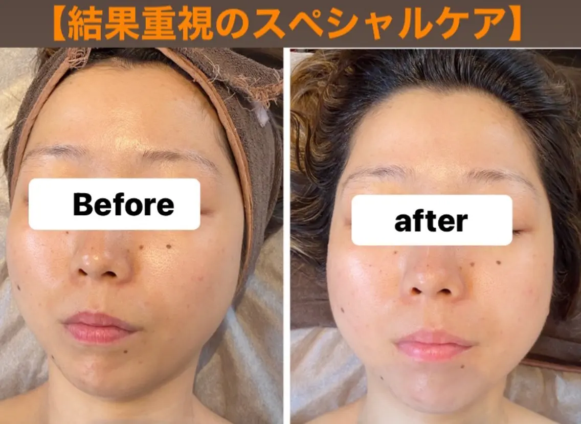 脱毛・エステサロン LuLuNのエステ・リラクイメージ