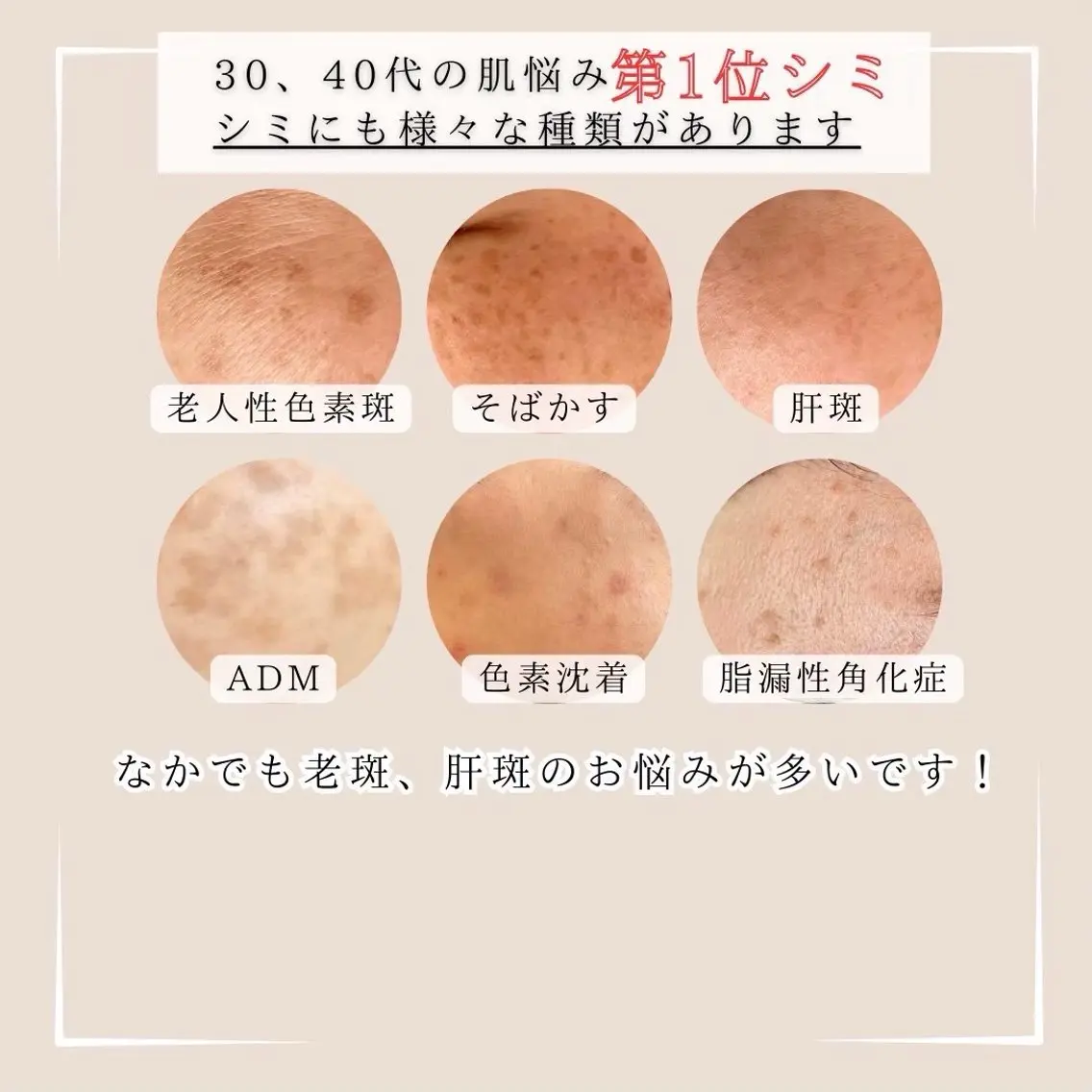 枝廣 貴子のエステ・リラクイメージ