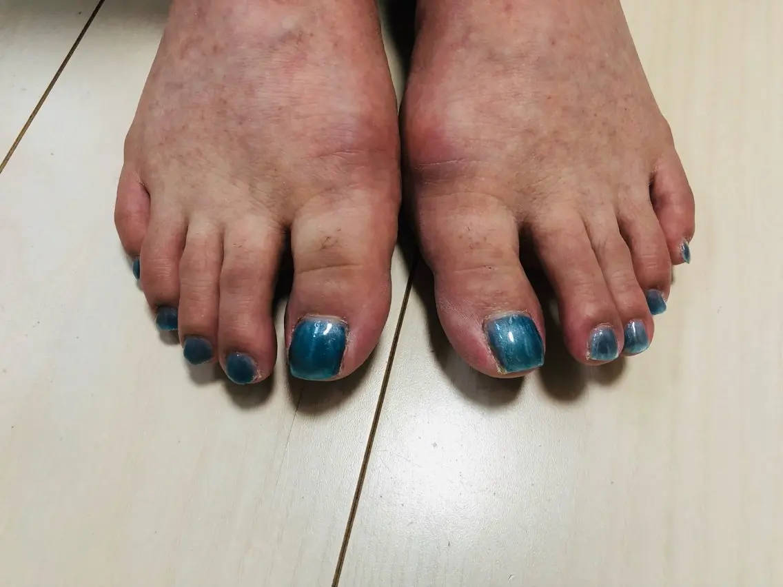 ネイル ブルー フットネイル マグネットネイル M&Y nailsalonのネイルデザイン