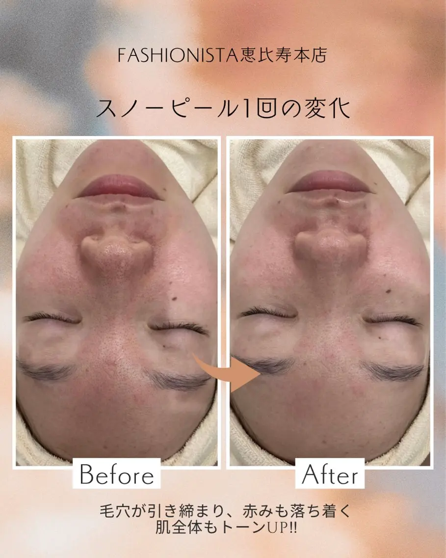 ファッショニスタ mihiroのエステ・リラクイメージ