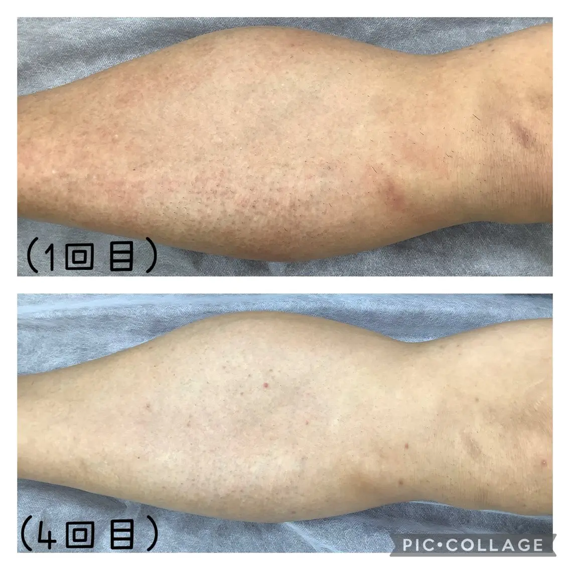 メンズ 脱毛 REONZ 取手店のエステ・リラクイメージ
