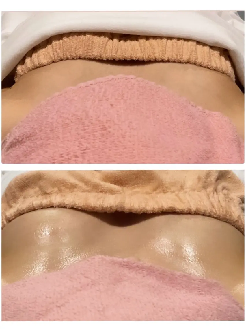 マシュマロバストアップღおためしの写真