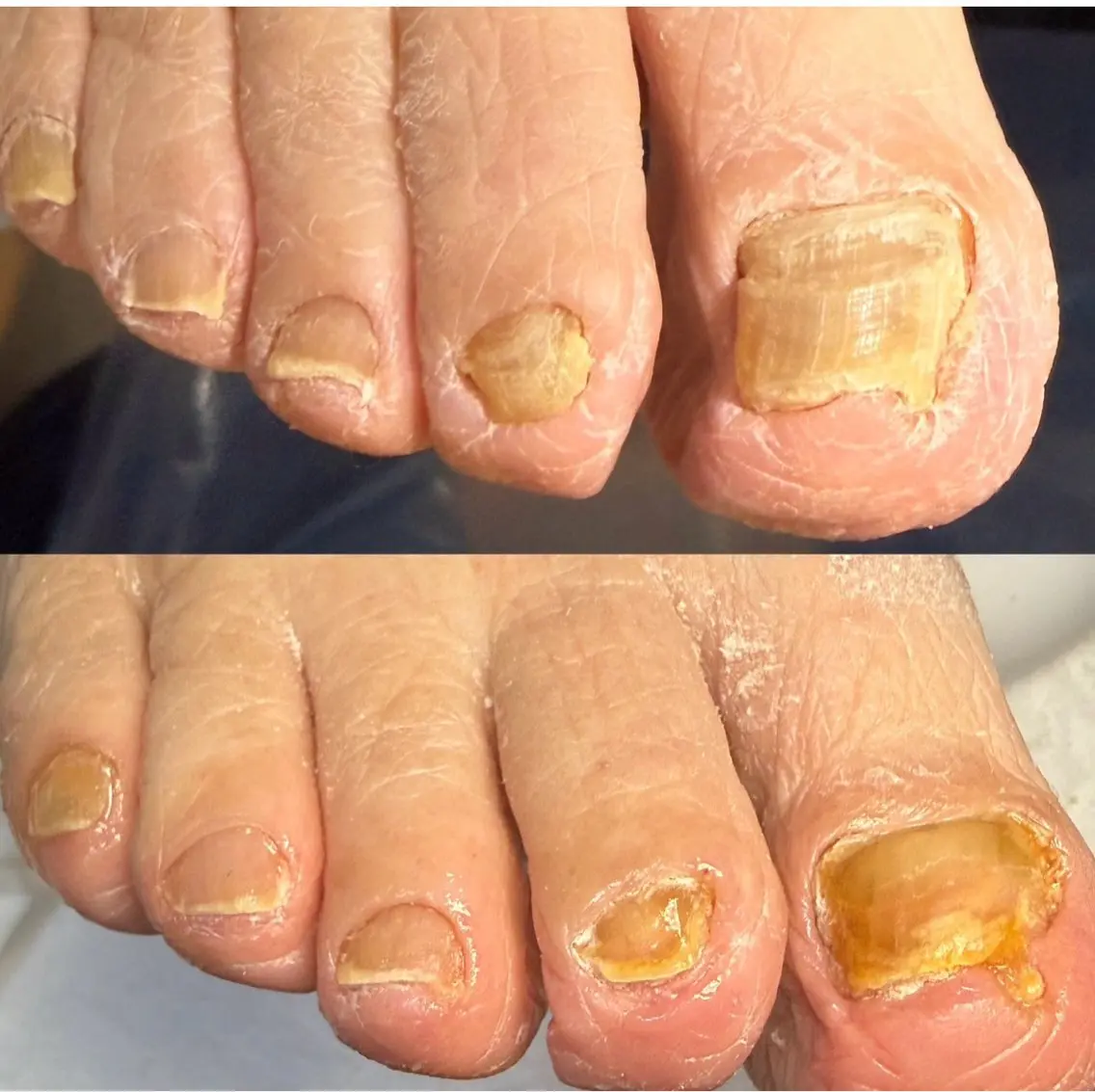 ネイル その他(ネイル) 地爪育成💅 kanaoanailのネイルデザイン