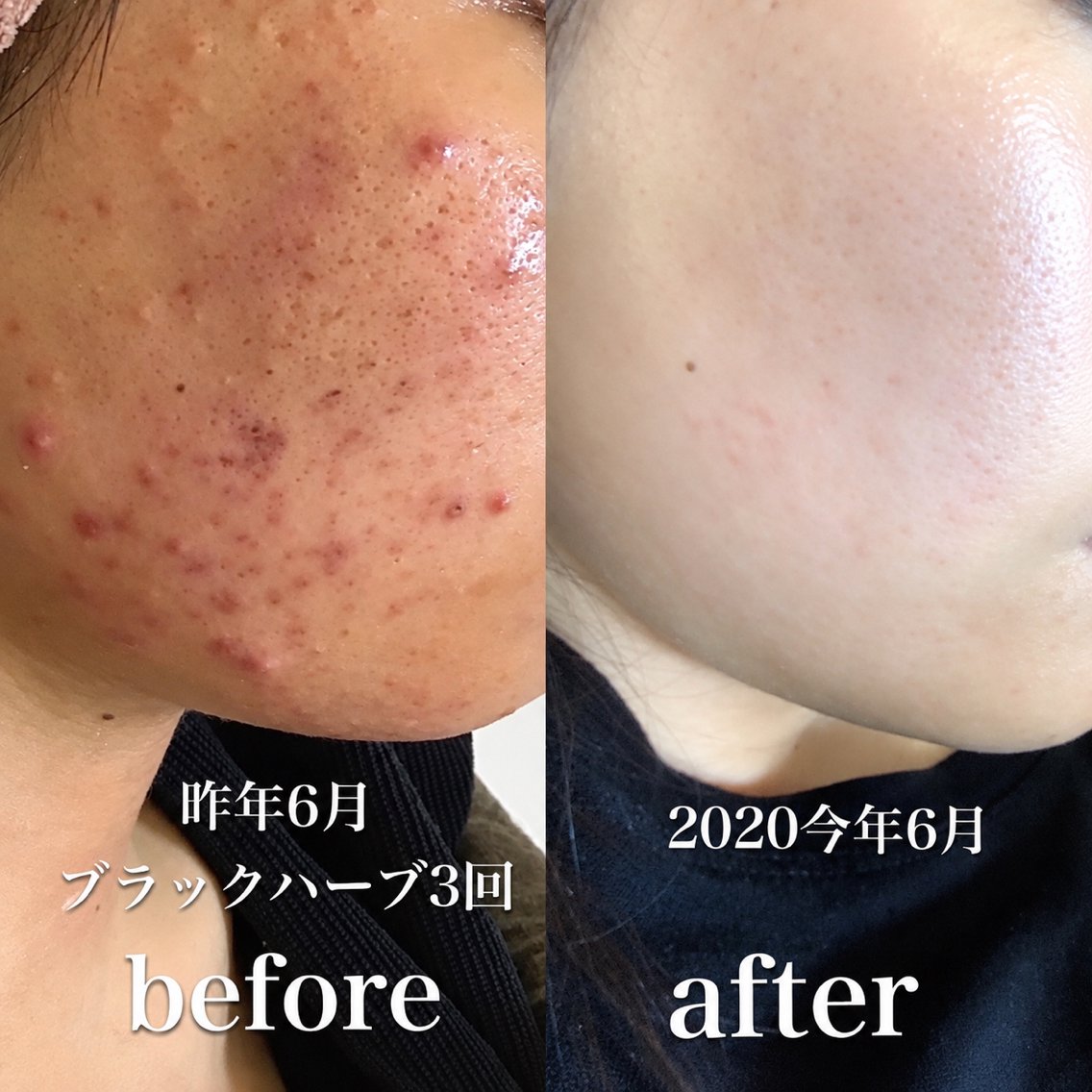 エステ リラク 美肌革命×本格痩身店 癒し隠れ家salonのエステ・リラクイメージ