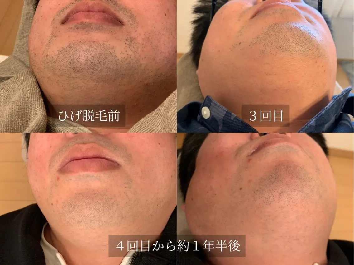 脱毛サロン Arumのエステ・リラクイメージ