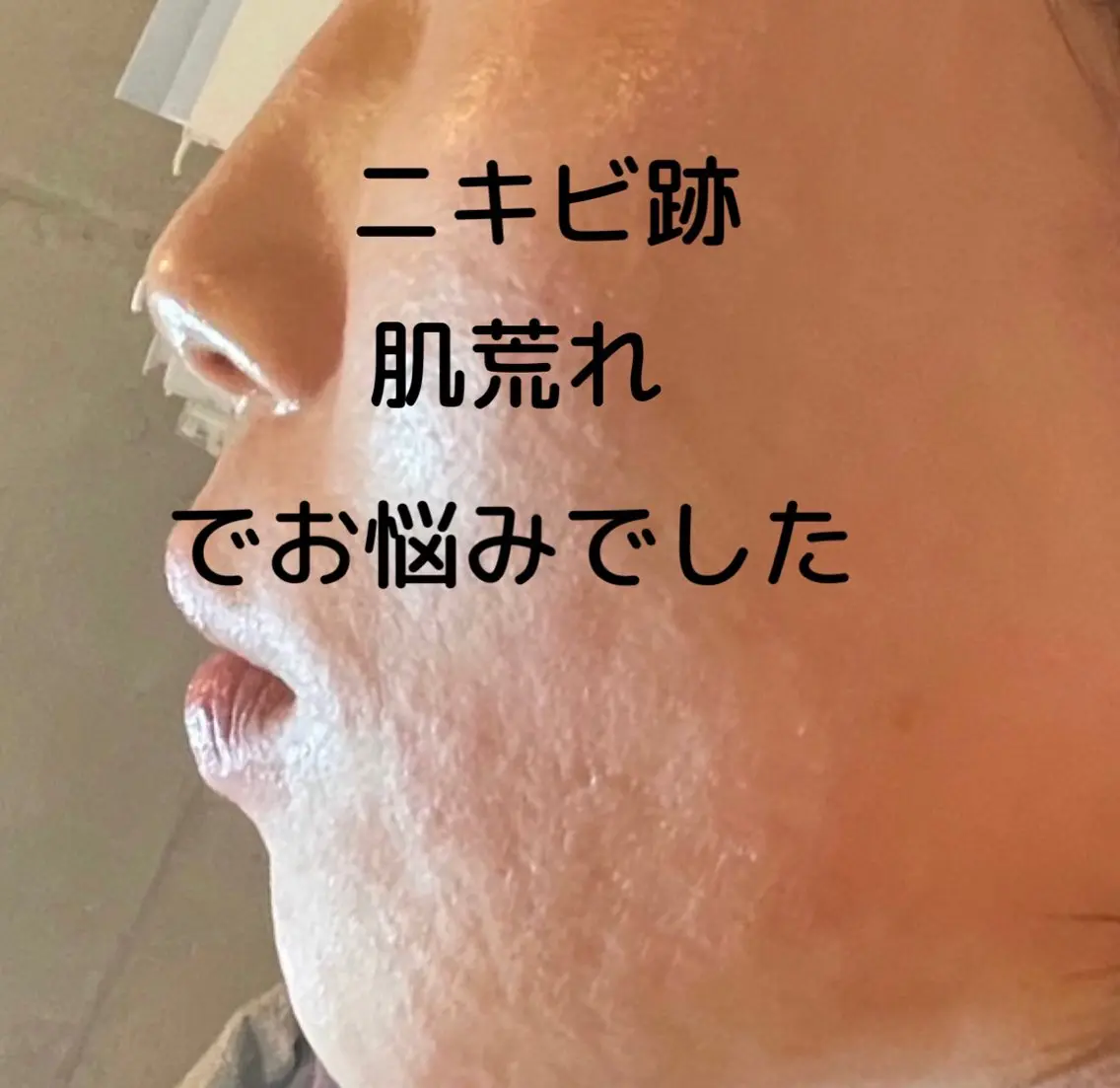 脱毛サロン mamanaのエステ・リラクイメージ
