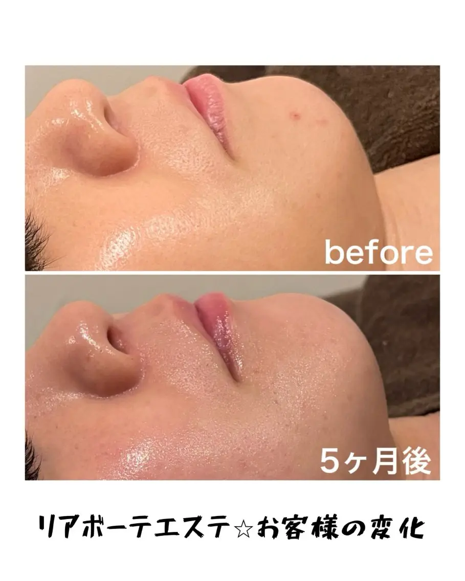 エステ 浜野 恵美のエステ・リラクイメージ