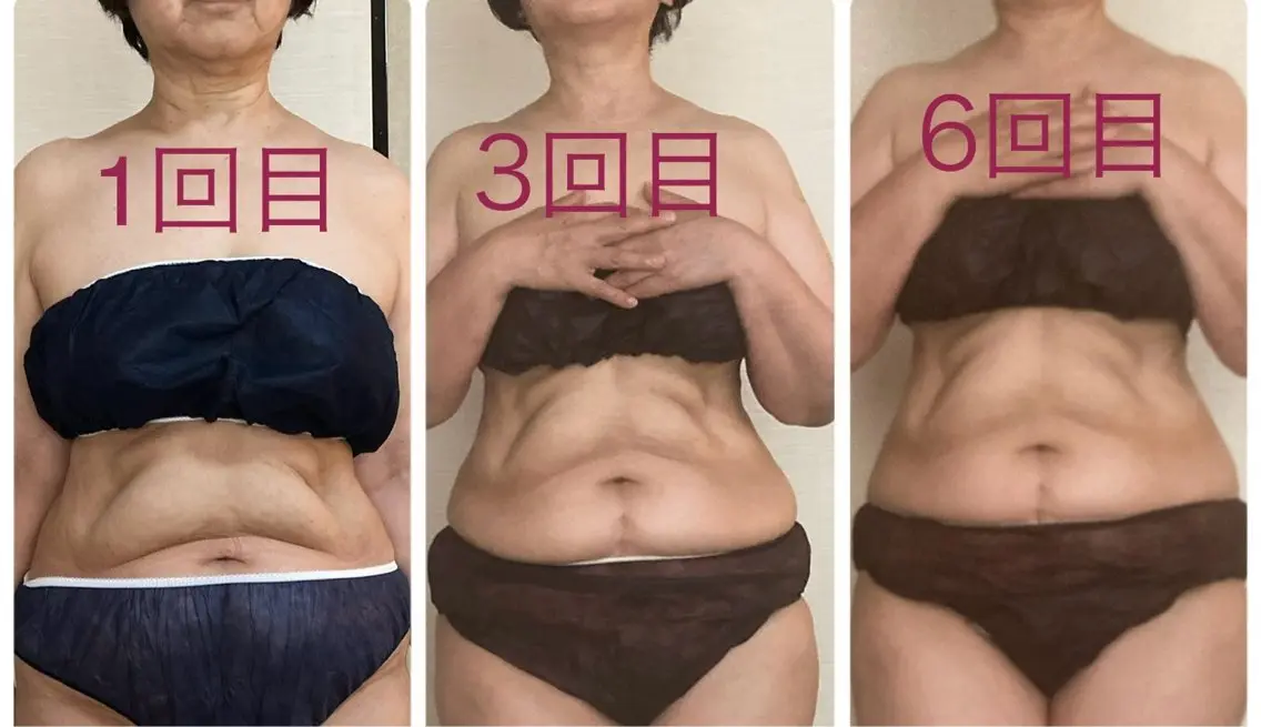 宮本 しおりのエステ・リラクイメージ