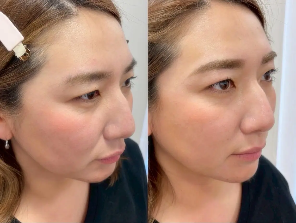 アイブロウ ワックス脱毛 眉カット その他(アイブロウ) rille mamiの眉毛・アイブロウイメージ