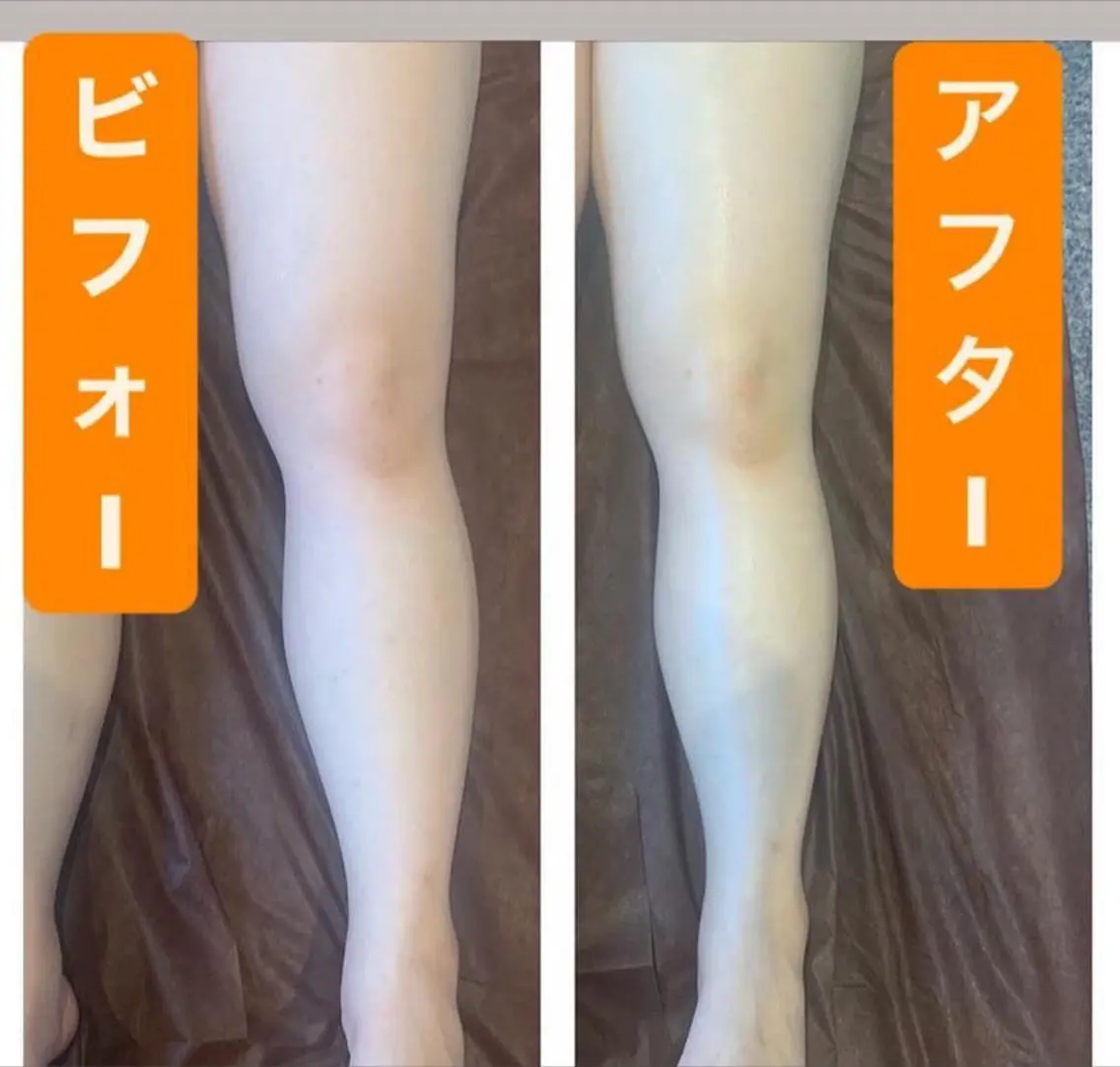 むくみスッキリコース　60分の写真