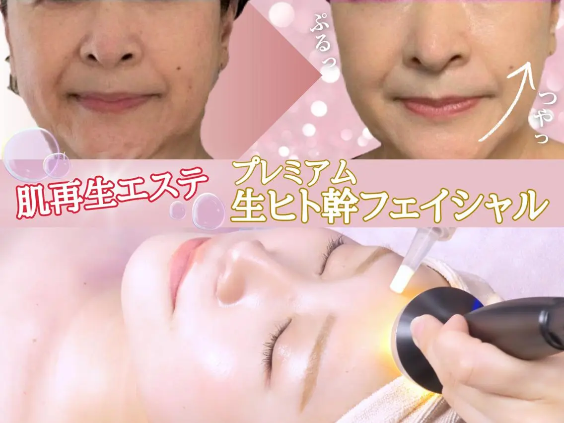 《IPS細胞で肌再生✨》プレミアム生ヒト幹フェイシャル🫧60 分【抗老化・シミ・しわ・肌育】の写真