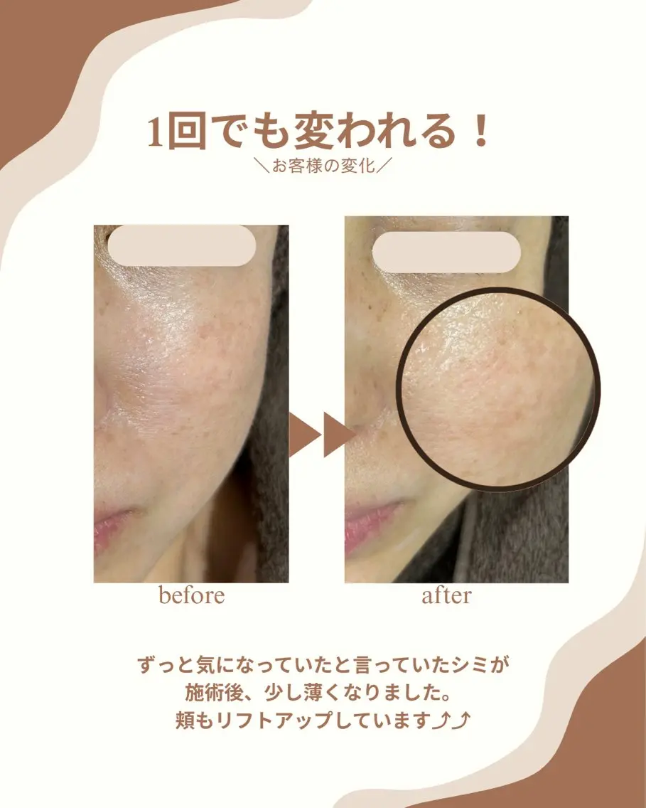 プライベートサロン COVOのエステ・リラクイメージ