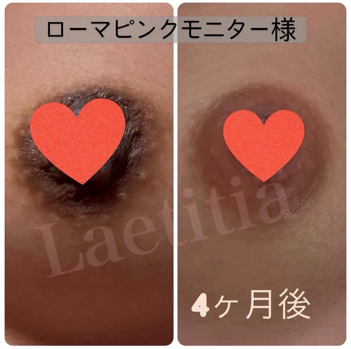 エステ レティティア (Laetitia)のエステ・リラクイメージ