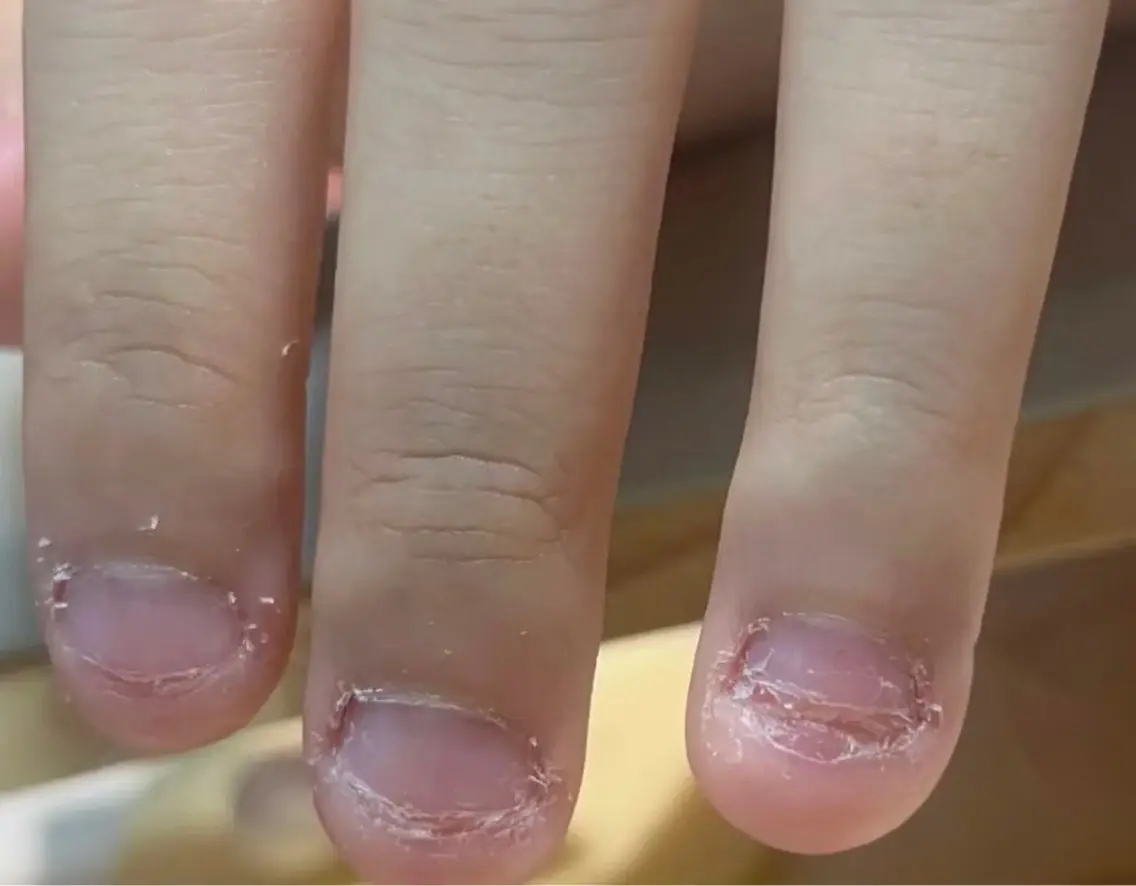 ネイル ハンドネイル MoonNail ユリ🌸のネイルデザイン