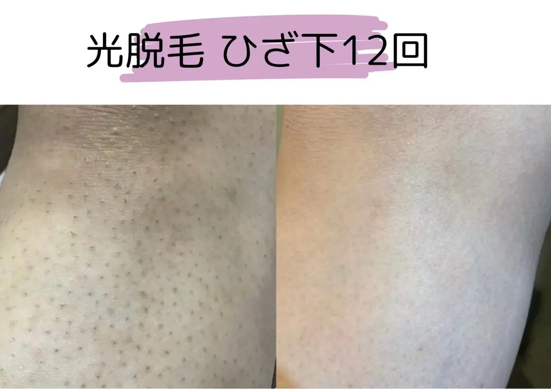 キッズ TRINTE 酒井のエステ・リラクイメージ
